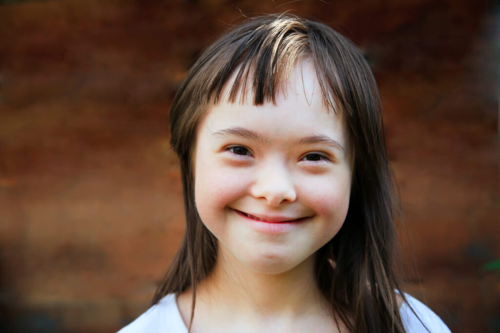 Cute,Smiling,Down,Syndrome,Girl,On,The,Brown,Background